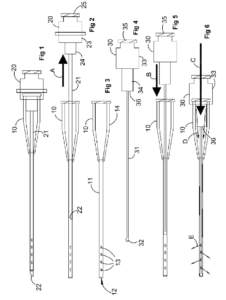 Patent drawings - Medical device, Method of treatment, medical patent